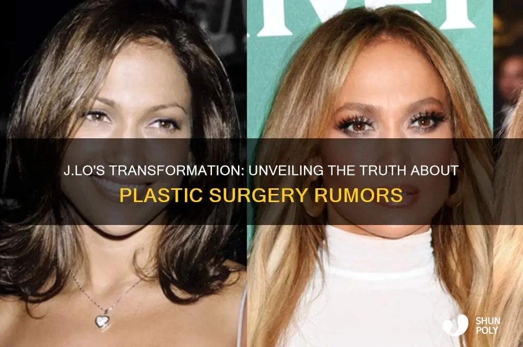 has j lo had plastic surgery