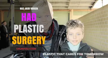 Jack Vidgen's Transformation: Plastic Surgery Speculations and Truths Revealed