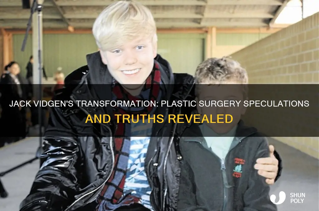 has jack vidgen had plastic surgery