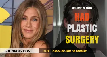 Has Jacklyn Smith Had Plastic Surgery? Unveiling the Truth
