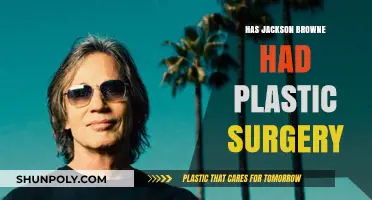 Jackson Browne's Appearance: Plastic Surgery Rumors Explored and Debunked