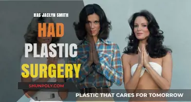 Jaclyn Smith's Ageless Beauty: Plastic Surgery Speculations Explored