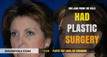 Has Jade From The Hills Undergone Plastic Surgery? The Truth Revealed