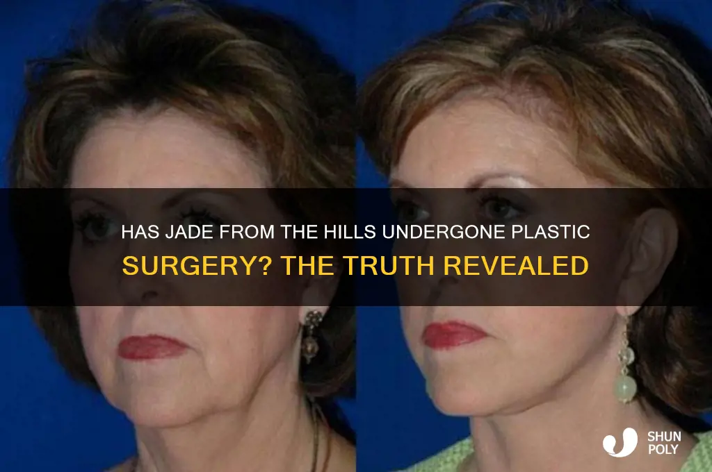 has jade from the hills had plastic surgery