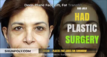 Has Jalo Had Plastic Surgery? Uncovering the Truth Behind the Rumors