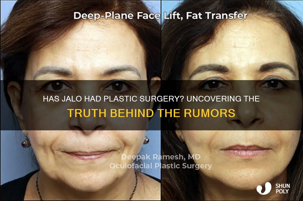 has jalo had plastic surgery