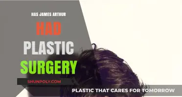 James Arthur's Transformation: Plastic Surgery Rumors Explored and Debunked