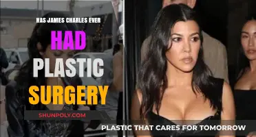 James Charles Plastic Surgery: Fact-Checking Rumors and Speculations