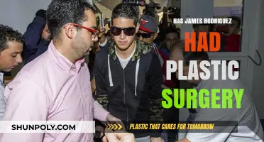 James Rodriguez Plastic Surgery: Fact or Fiction? Unveiling the Truth
