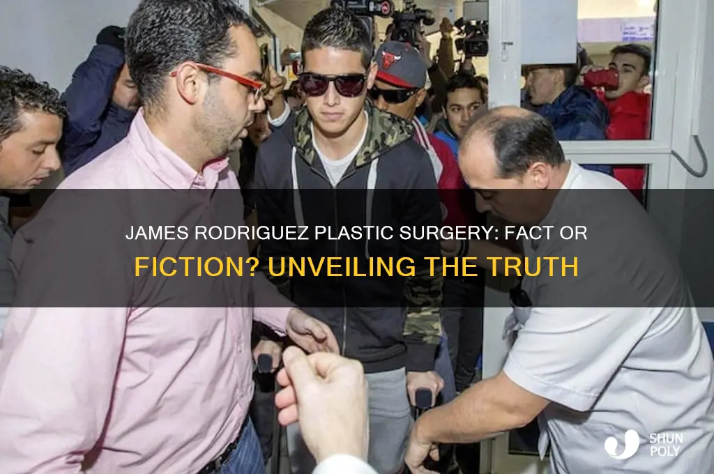 has james rodriguez had plastic surgery