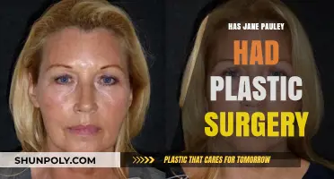 Jane Pauley's Transformation: Plastic Surgery Speculations and Truths