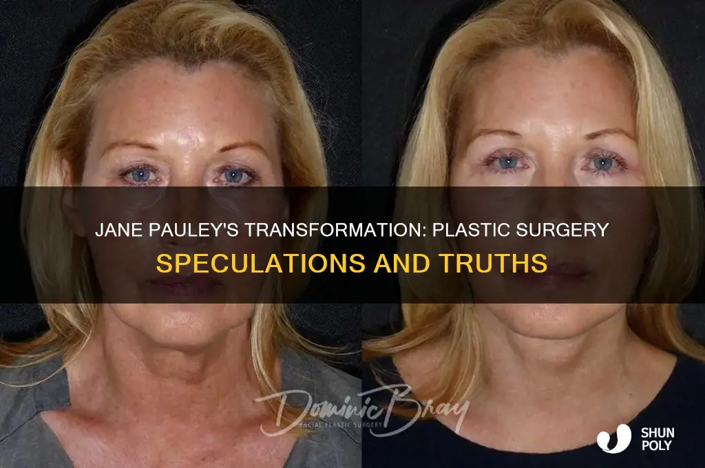 has jane pauley had plastic surgery