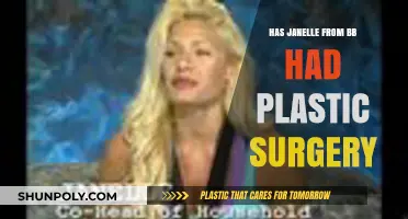 Janelle's Transformation: Plastic Surgery Rumors and Reality Explored