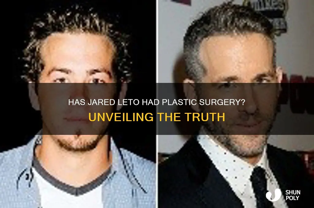has jared leto gotten plastic surgery