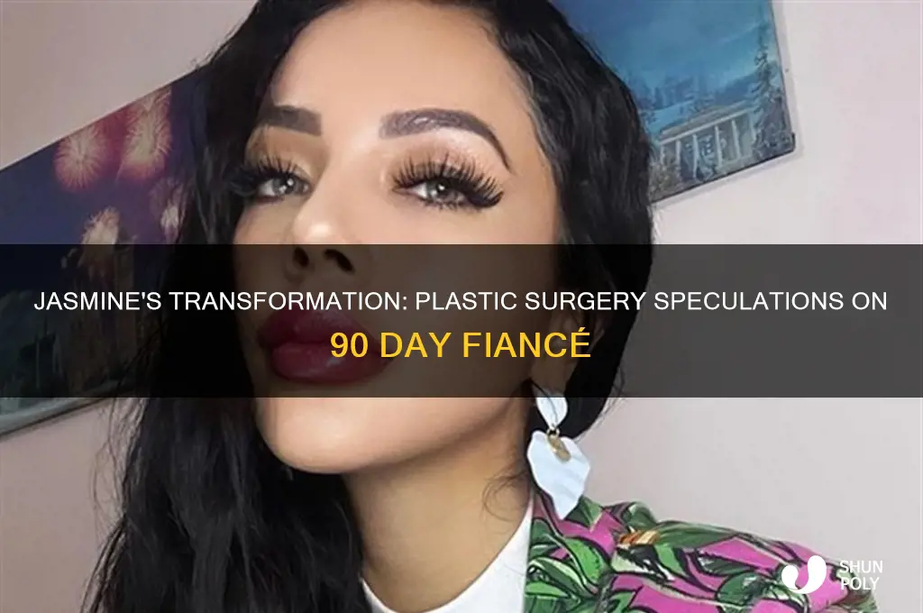 has jasmine from 90 day fiance had plastic surgery