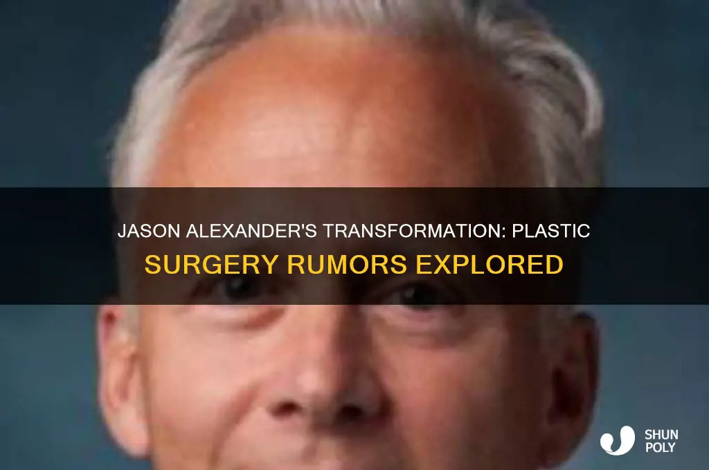 has jason alexander had plastic surgery