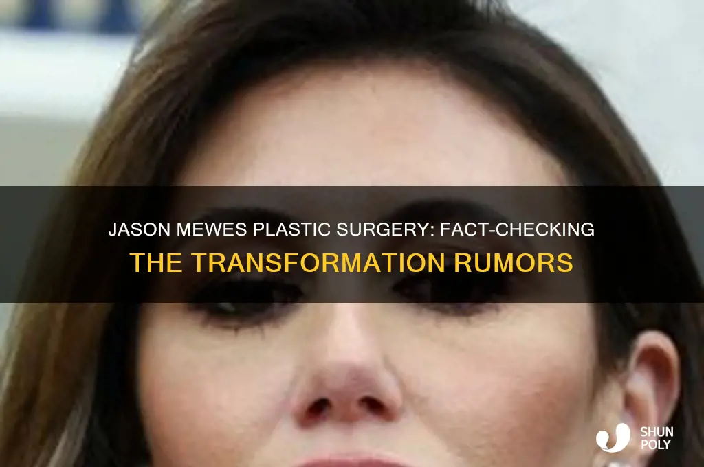 has jason mewes had plastic surgery
