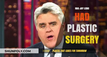 Jay Leno's Transformation: Plastic Surgery Rumors and Speculations