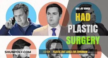 Has JD Vance Had Plastic Surgery? Uncovering the Truth