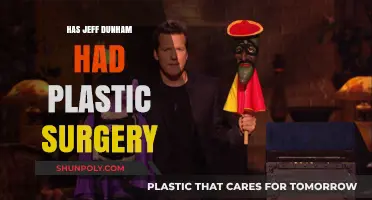 Jeff Dunham's Appearance: Plastic Surgery Speculations and Facts Revealed