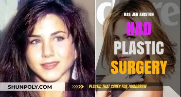 Has Jen Aniston Had Plastic Surgery? Unveiling the Truth