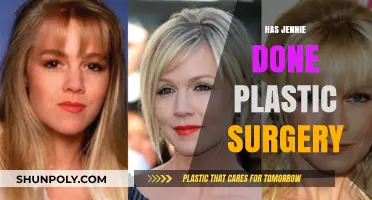 Has Jennie Undergone Plastic Surgery? Unraveling the Truth and Speculations