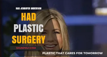 Jennifer Anderson's Transformation: Plastic Surgery Speculations and Truths