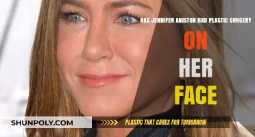 Jennifer Aniston's Face: Natural Beauty or Plastic Surgery?