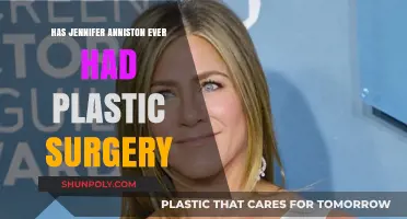 Jennifer Aniston's Beauty Secrets: Plastic Surgery Rumors Explored