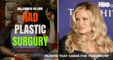 Plastic Surgery Speculation: Jennifer Coolidge's Transformation