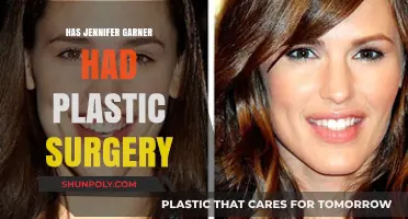 Jennifer Garner's Transformation: Plastic Surgery Speculations and Truths