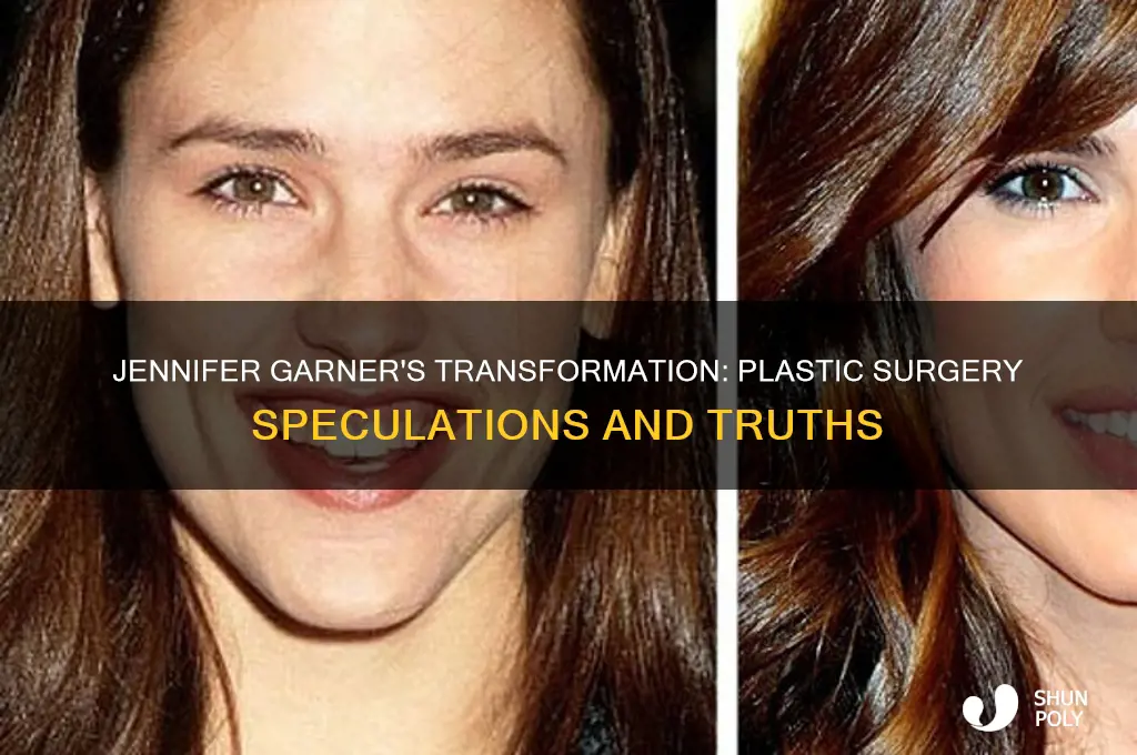 has jennifer garner had plastic surgery