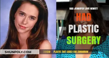 Jennifer Love Hewitt Plastic Surgery: Fact-Checking the Rumors and Speculations