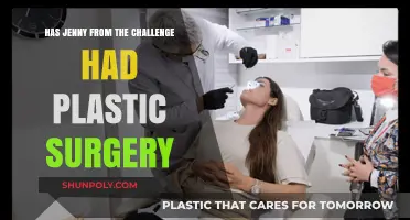 Jenny from The Challenge: Plastic Surgery Rumors Explored