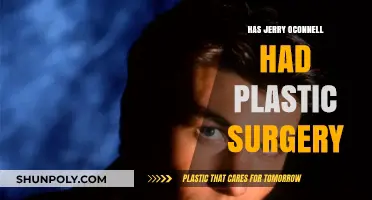 Jerry O'Connell Plastic Surgery: Fact-Checking the Transformation Rumors
