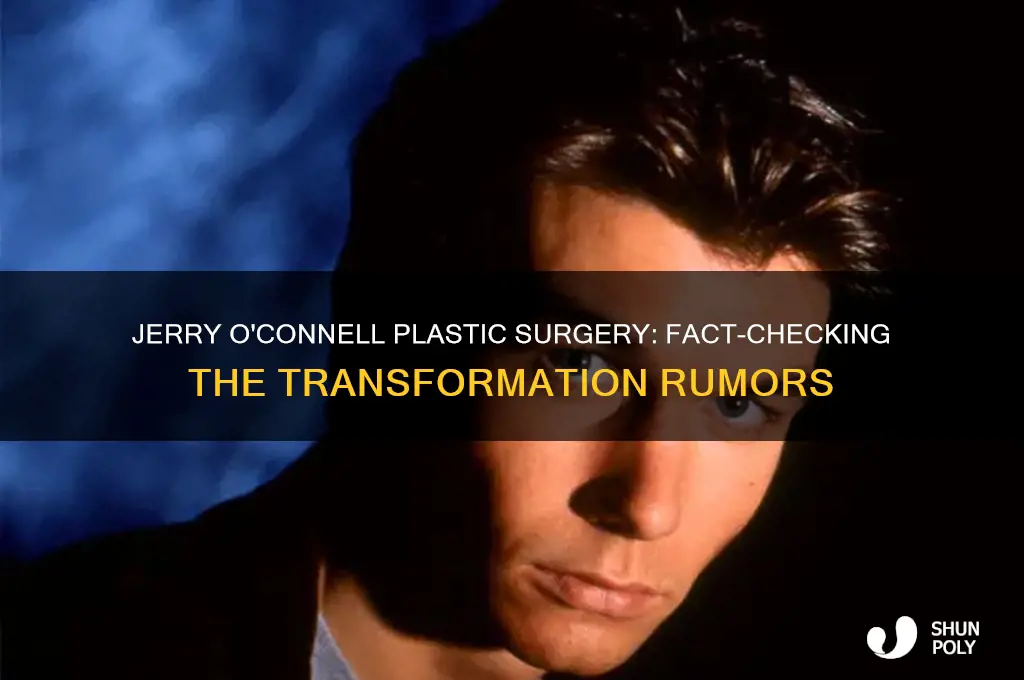 has jerry oconnell had plastic surgery