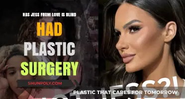 Jess from Love is Blind: Plastic Surgery Speculations and Truths