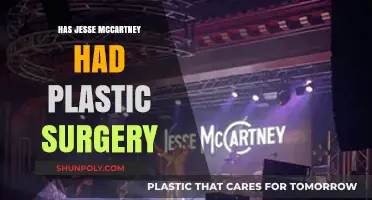Jesse McCartney Plastic Surgery: Fact or Fiction? Unveiling the Truth