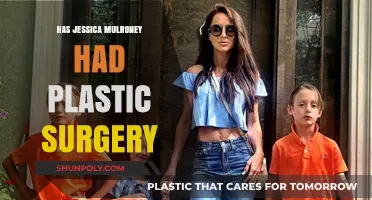 Jessica Mulroney's Transformation: Plastic Surgery Rumors Explored