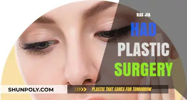 Has Jia Had Plastic Surgery? Unveiling the Truth Behind the Rumors