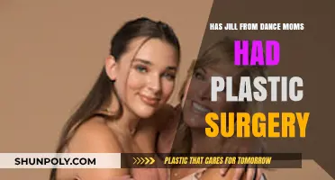 Jill from Dance Moms: Plastic Surgery Speculations and Truths