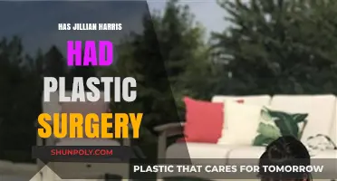 Jillian Harris Plastic Surgery: Fact-Checking the Rumors and Speculations