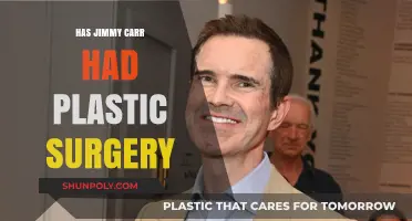 Jimmy Carr's Transformation: Plastic Surgery Rumors Explored and Debunked