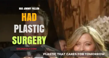 Jimmy Fallon's Appearance: Plastic Surgery Speculations and Rumors Explored