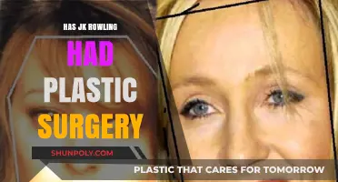 JK Rowling's Transformation: Plastic Surgery Speculations and Facts Revealed
