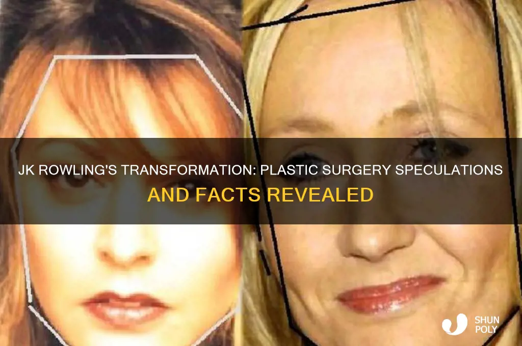 has jk rowling had plastic surgery