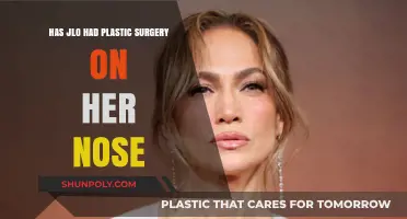 JLo's Nose Transformation: Plastic Surgery Speculations and Facts