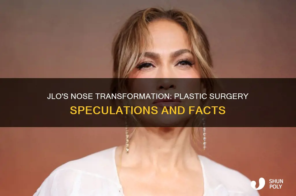 has jlo had plastic surgery on her nose