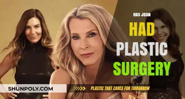 Joan's Transformation: Plastic Surgery Rumors and the Truth Behind Them