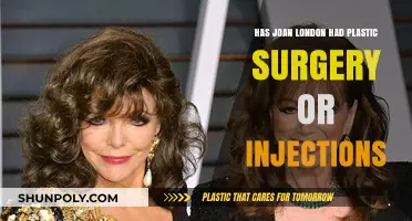 Joan London's Appearance: Plastic Surgery or Natural Aging?